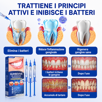 🎁🎁𝑲𝒆𝒚𝒆𝒔𝒔®𝑮𝒖𝒎𝑹𝒆𝒗𝒊𝒗𝒆 𝑮𝒆𝒍 𝑹𝒊𝒑𝒂𝒓𝒂𝒕𝒐𝒓𝒆 𝑷𝒂𝒓𝒐𝒅𝒐𝒏𝒕𝒂𝒍𝒆