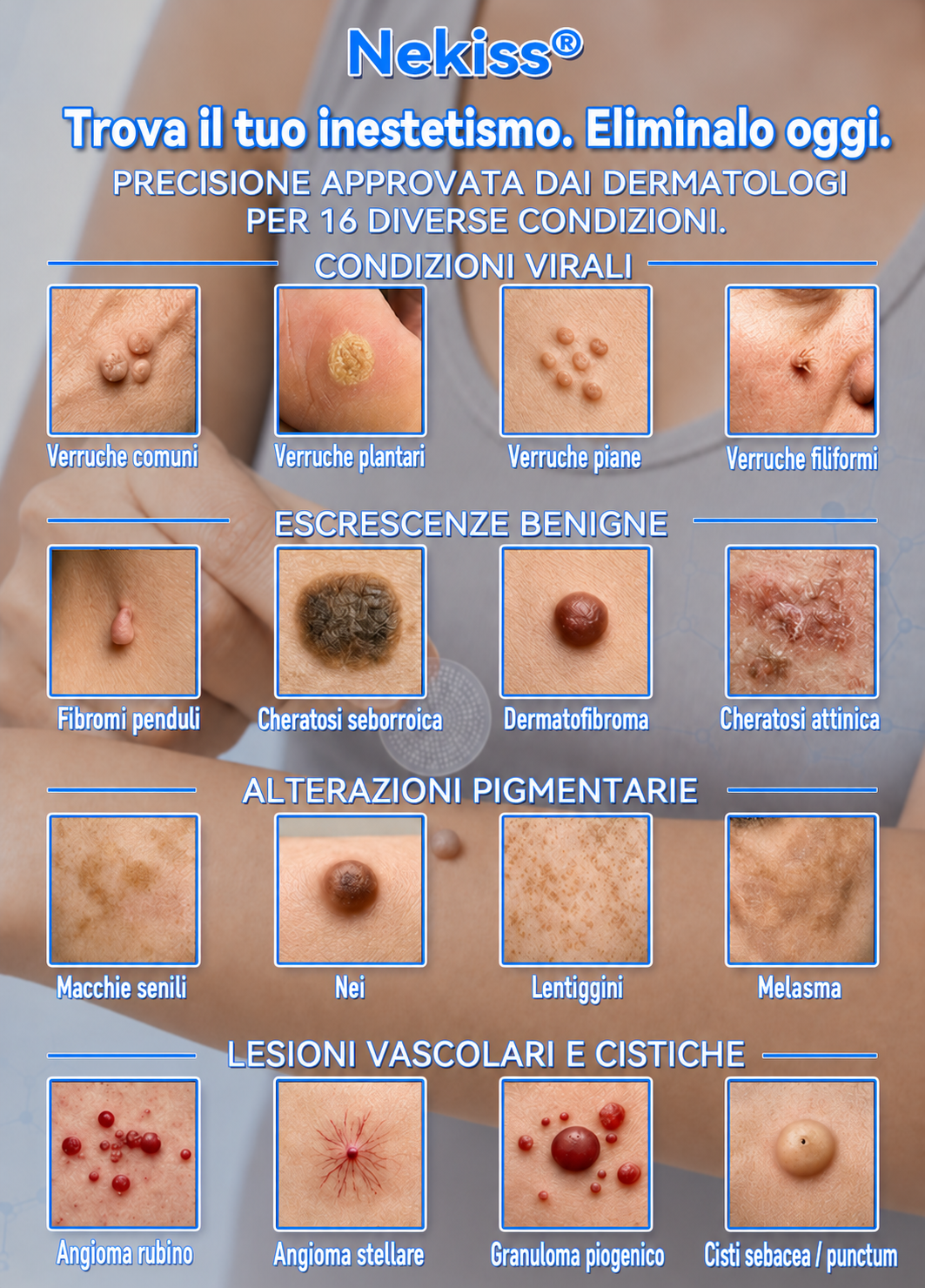 👩‍⚕️🥇 𝑁𝑒𝑔𝑜𝑧𝑖𝑜 𝑈𝑓𝑓𝑖𝑐𝑖𝑎𝑙𝑒 | 𝑵𝐞𝒌𝐢𝐬𝐬® 𝑀𝑖𝑐𝑟𝑜𝑎𝑔ℎ𝑖 𝑃𝑒𝑙𝑙𝑒 𝑃𝑒𝑟𝑓𝑒𝑡𝑡𝑎 𝑅𝑖𝑚𝑜𝑧𝑖𝑜𝑛𝑒 𝐷𝑒𝑙𝑙𝑒 𝑉𝑒𝑟𝑟𝑢𝑐ℎ𝑒 𝐶𝑒𝑟𝑜𝑡𝑡𝑜 (𝑃𝑜𝑢𝑟 𝑙𝑒𝑠 é𝑡𝑖𝑞𝑢𝑒𝑡𝑡𝑒𝑠 𝑐𝑢𝑡𝑎𝑛é𝑒𝑠, 𝑙𝑒𝑠 𝑝𝑒𝑡𝑖𝑡𝑒𝑠 𝑒𝑥𝑐𝑟𝑜𝑖𝑠𝑠𝑎𝑛𝑐𝑒𝑠 𝑐𝑢𝑡𝑎𝑛é𝑒𝑠, 𝑙𝑒𝑠 𝑣𝑒𝑟𝑟𝑢𝑒𝑠, 𝑙𝑒𝑠 𝑔𝑟𝑎𝑖𝑛𝑠 𝑑𝑒 𝑏𝑒𝑎𝑢𝑡é, 𝑙𝑒𝑠 𝑡𝑎𝑐ℎ𝑒𝑠 𝑑𝑒 𝑣𝑖𝑒𝑖𝑙𝑙𝑒𝑠𝑠𝑒 𝑒𝑡 𝑙𝑒𝑠 𝑝𝑟𝑜𝑏𝑙è𝑚𝑒𝑠 𝑑𝑒 𝑝𝑖𝑔𝑚𝑒𝑛𝑡𝑎𝑡𝑖𝑜𝑛)