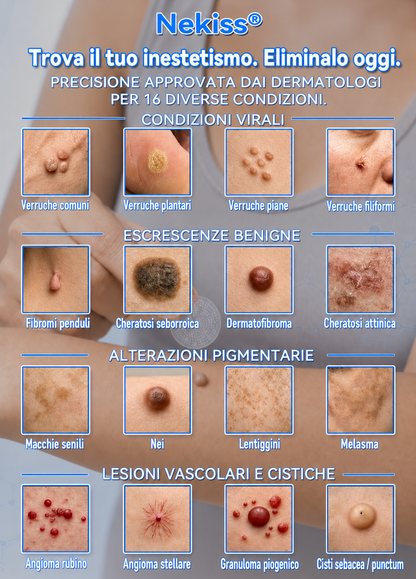 👩‍⚕️🥇 𝑁𝑒𝑔𝑜𝑧𝑖𝑜 𝑈𝑓𝑓𝑖𝑐𝑖𝑎𝑙𝑒 | 𝑵𝐞𝒌𝐢𝐬𝐬® 𝑀𝑖𝑐𝑟𝑜𝑎𝑔ℎ𝑖 𝑃𝑒𝑙𝑙𝑒 𝑃𝑒𝑟𝑓𝑒𝑡𝑡𝑎 𝑅𝑖𝑚𝑜𝑧𝑖𝑜𝑛𝑒 𝐷𝑒𝑙𝑙𝑒 𝑉𝑒𝑟𝑟𝑢𝑐ℎ𝑒 𝐶𝑒𝑟𝑜𝑡𝑡𝑜 (𝑃𝑜𝑢𝑟 𝑙𝑒𝑠 é𝑡𝑖𝑞𝑢𝑒𝑡𝑡𝑒𝑠 𝑐𝑢𝑡𝑎𝑛é𝑒𝑠, 𝑙𝑒𝑠 𝑝𝑒𝑡𝑖𝑡𝑒𝑠 𝑒𝑥𝑐𝑟𝑜𝑖𝑠𝑠𝑎𝑛𝑐𝑒𝑠 𝑐𝑢𝑡𝑎𝑛é𝑒𝑠, 𝑙𝑒𝑠 𝑣𝑒𝑟𝑟𝑢𝑒𝑠, 𝑙𝑒𝑠 𝑔𝑟𝑎𝑖𝑛𝑠 𝑑𝑒 𝑏𝑒𝑎𝑢𝑡é, 𝑙𝑒𝑠 𝑡𝑎𝑐ℎ𝑒𝑠 𝑑𝑒 𝑣𝑖𝑒𝑖𝑙𝑙𝑒𝑠𝑠𝑒 𝑒𝑡 𝑙𝑒𝑠 𝑝𝑟𝑜𝑏𝑙è𝑚𝑒𝑠 𝑑𝑒 𝑝𝑖𝑔𝑚𝑒𝑛𝑡𝑎𝑡𝑖𝑜𝑛)