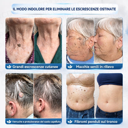 🌌𝐏𝐢𝐜𝐝𝐨® 𝑪𝒓𝒆𝒎𝒂 𝑬𝒍𝒊𝒎𝒊𝒏𝒂 𝑴𝒂𝒄𝒄𝒉𝒊𝒆 𝑪𝒖𝒕𝒂𝒏𝒆𝒆 7 𝑮𝒊𝒐𝒓𝒏𝒊🩵 (𝑭𝒐𝒓𝒎𝒖𝒍𝒂 𝒁𝒆𝒓𝒐 𝑫𝒐𝒍𝒐𝒓𝒆, 𝒁𝒆𝒓𝒐 𝑺𝒆𝒈𝒏𝒊)💪