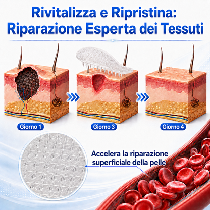 👩‍⚕️🥇 𝑁𝑒𝑔𝑜𝑧𝑖𝑜 𝑈𝑓𝑓𝑖𝑐𝑖𝑎𝑙𝑒 | 𝑵𝐞𝒌𝐢𝐬𝐬® 𝑀𝑖𝑐𝑟𝑜𝑎𝑔ℎ𝑖 𝑃𝑒𝑙𝑙𝑒 𝑃𝑒𝑟𝑓𝑒𝑡𝑡𝑎 𝑅𝑖𝑚𝑜𝑧𝑖𝑜𝑛𝑒 𝐷𝑒𝑙𝑙𝑒 𝑉𝑒𝑟𝑟𝑢𝑐ℎ𝑒 𝐶𝑒𝑟𝑜𝑡𝑡𝑜 (𝑃𝑜𝑢𝑟 𝑙𝑒𝑠 é𝑡𝑖𝑞𝑢𝑒𝑡𝑡𝑒𝑠 𝑐𝑢𝑡𝑎𝑛é𝑒𝑠, 𝑙𝑒𝑠 𝑝𝑒𝑡𝑖𝑡𝑒𝑠 𝑒𝑥𝑐𝑟𝑜𝑖𝑠𝑠𝑎𝑛𝑐𝑒𝑠 𝑐𝑢𝑡𝑎𝑛é𝑒𝑠, 𝑙𝑒𝑠 𝑣𝑒𝑟𝑟𝑢𝑒𝑠, 𝑙𝑒𝑠 𝑔𝑟𝑎𝑖𝑛𝑠 𝑑𝑒 𝑏𝑒𝑎𝑢𝑡é, 𝑙𝑒𝑠 𝑡𝑎𝑐ℎ𝑒𝑠 𝑑𝑒 𝑣𝑖𝑒𝑖𝑙𝑙𝑒𝑠𝑠𝑒 𝑒𝑡 𝑙𝑒𝑠 𝑝𝑟𝑜𝑏𝑙è𝑚𝑒𝑠 𝑑𝑒 𝑝𝑖𝑔𝑚𝑒𝑛𝑡𝑎𝑡𝑖𝑜𝑛)