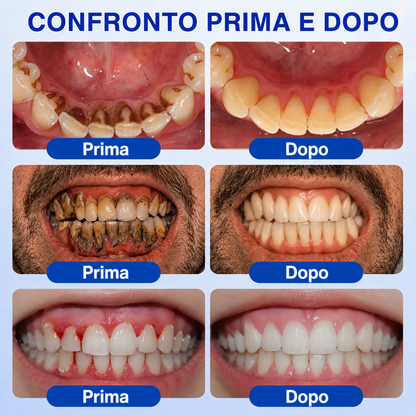 🎁🎁𝑲𝒆𝒚𝒆𝒔𝒔®𝑮𝒖𝒎𝑹𝒆𝒗𝒊𝒗𝒆 𝑮𝒆𝒍 𝑹𝒊𝒑𝒂𝒓𝒂𝒕𝒐𝒓𝒆 𝑷𝒂𝒓𝒐𝒅𝒐𝒏𝒕𝒂𝒍𝒆