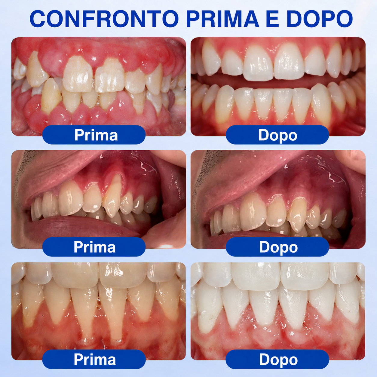 🎁🎁𝑲𝒆𝒚𝒆𝒔𝒔®𝑮𝒖𝒎𝑹𝒆𝒗𝒊𝒗𝒆 𝑮𝒆𝒍 𝑹𝒊𝒑𝒂𝒓𝒂𝒕𝒐𝒓𝒆 𝑷𝒂𝒓𝒐𝒅𝒐𝒏𝒕𝒂𝒍𝒆