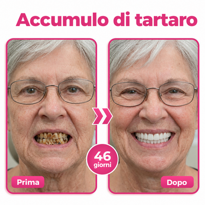 🌍𝑶𝒚𝒊𝑲𝒆𝒚® 𝑻𝒉𝒊𝒔𝒎𝒊𝒍𝒆 𝑵𝑯-10 – 𝑺𝒊𝒆𝒓𝒐 𝑫𝒆𝒏𝒕𝒊𝒇𝒓𝒊𝒄𝒊𝒐 𝑷𝒆𝒓 𝑰𝒍 𝑻𝒓𝒂𝒕𝒕𝒂𝒎𝒆𝒏𝒕𝒐 𝑨𝒗𝒂𝒏𝒛𝒂𝒕𝒐 𝑫𝒊 𝑺𝒎𝒂𝒍𝒕𝒐 𝑬 𝑮𝒆𝒏𝒈𝒊𝒗𝒆